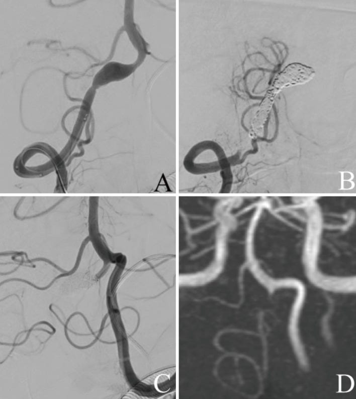 An external file that holds a picture, illustration, etc.
Object name is 2188-4226-9-0095-g002.jpg