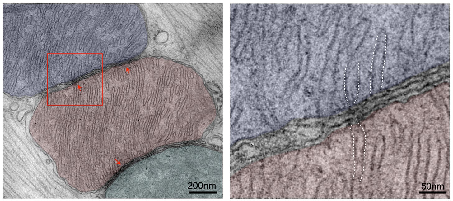 Electron microscope image of the cristae of adjacent mitochondria aligning across intermitochoncrial junctions. Electron microscope image of the cristae of adjacent mitochondria aligning across intermitochoncrial junctions.