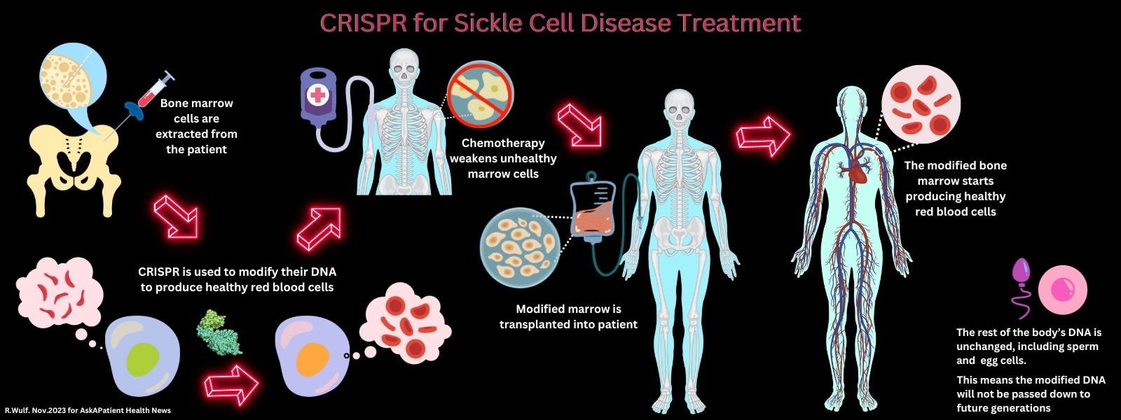 CRISPR for Sickle Cell Disease Treatment