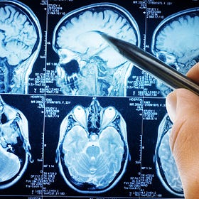 A Curious Case of Aluminum, Vaccines, Autism & Censorship Before COVID