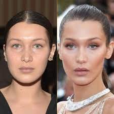 Dr Patrick Briggs Specialist Plastic Surgeon - ✨BUCCAL FAT REMOVAL ✨ Buccal  Fat Removal is a procedure that involves removing the Buccal fat or fat  pads within the cheeks to achieve a