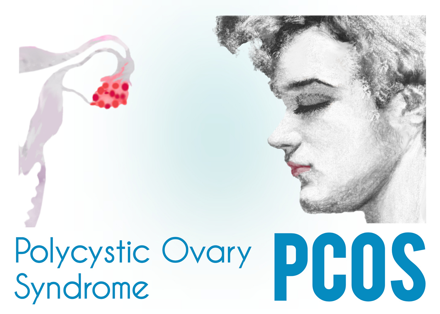 Mixed media collage showing: on the left, part of the female internal reproductive organs with an inflamed ovary with several cysts in shades of reds painted in watercolour; on the right, a female face in profile with excessive hair on the chin and sideburns, stylised in charcoal. The text in blue reads: Polycystic Ovary Syndrome, PCOS.