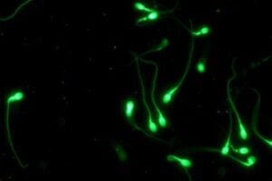 Sample of human spermatozoa.
