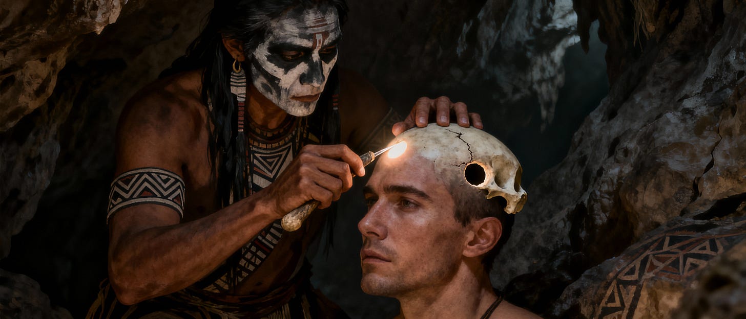Chamán realiza trepanación en cueva, rostro humano con pinturas de ceniza y luz del agujero parietal.