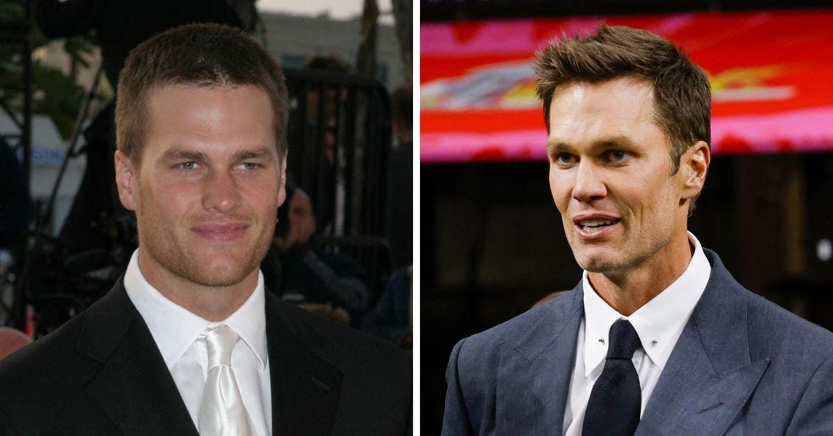 Did Tom Brady Get Plastic Surgery? Inside The Rumors Did Tom Brady Get Plastic Surgery? Inside The Rumors