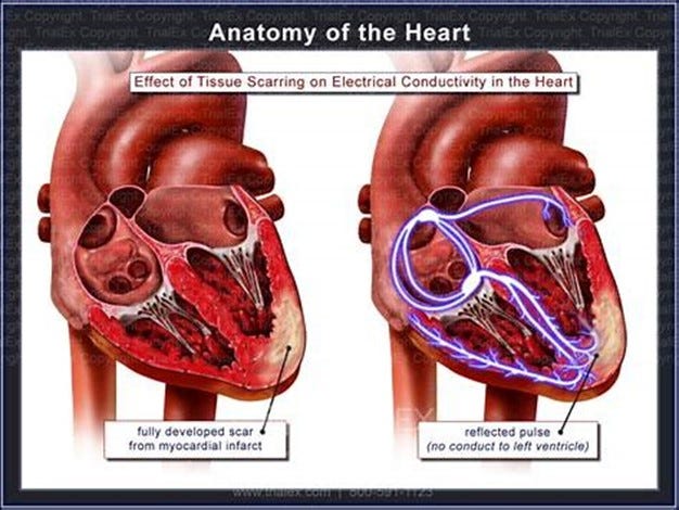 heart 