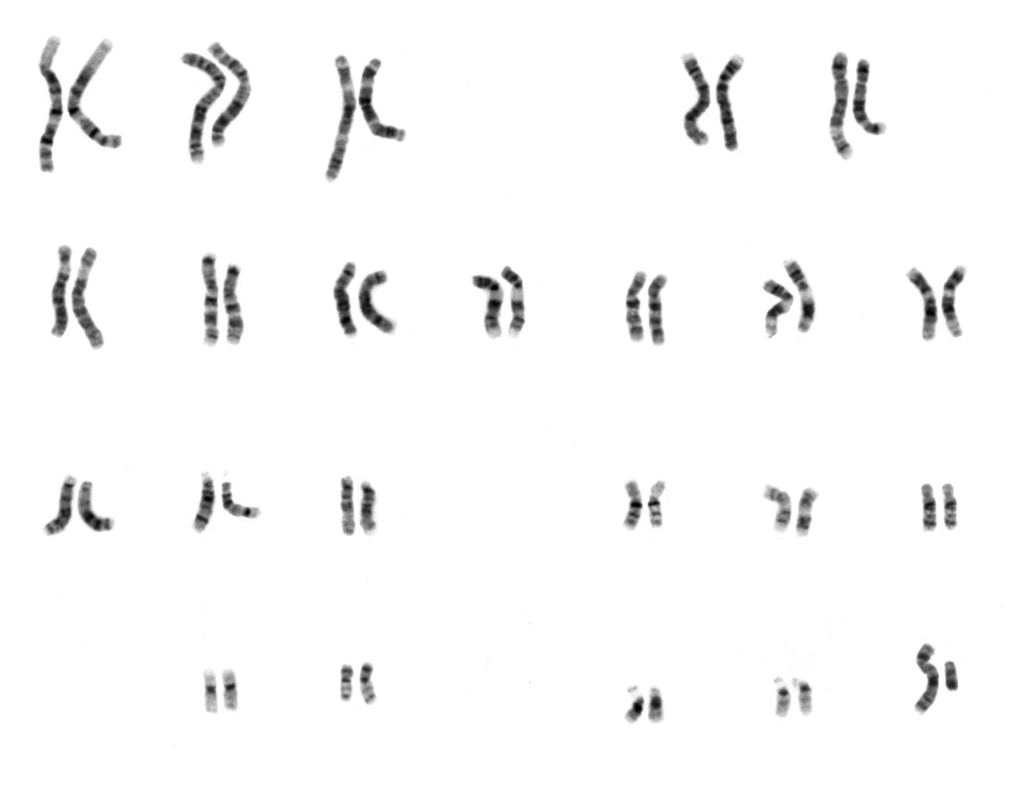 Karyotype - Wikipedia