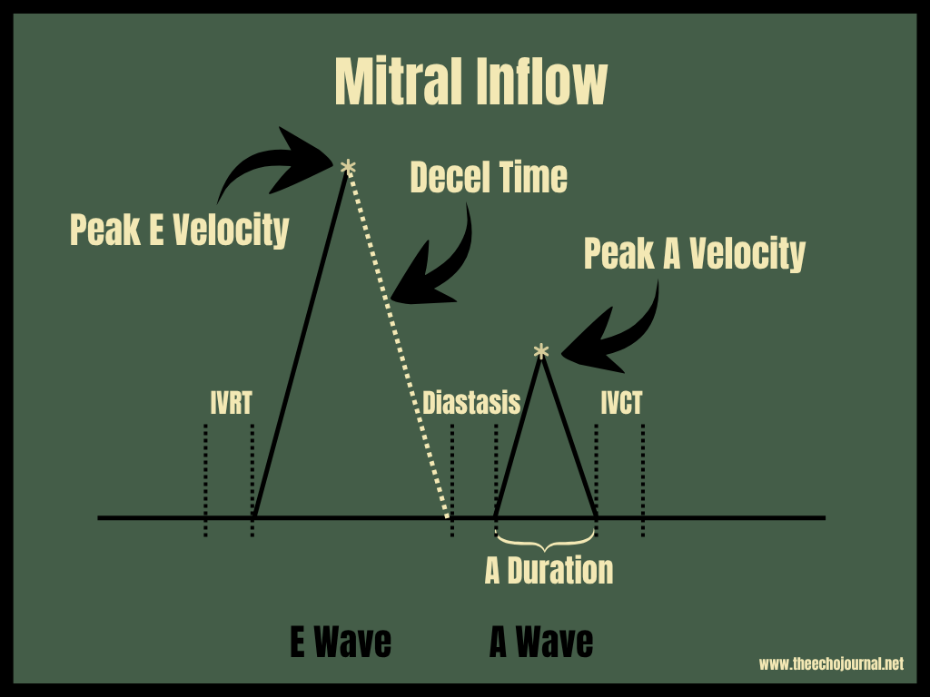 Ivrt Normal Values UPDATE! Navigating Diastolic Dysfunction Has Changed — Here’s What You ...