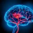 Tenecteplase for acute ischemic stroke presenting after 4.5 hours (TIMELESS trial)