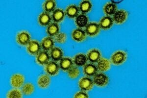 Colorized transmission electron micrograph of influenza A/H1N1 virus particles.