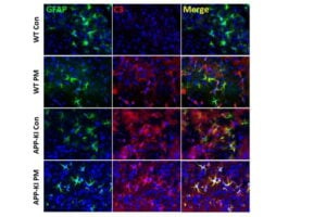 The study examined the brains of two types of mice: normal mice and mice with Alzheimer's disease. The mice were exposed to purified air or very small particles in the air. The researchers wanted to see if there were any changes in a type of brain cell called astrocytes. The astrocytes were stained green in the images, and the harmful and activated astrocytes appeared red. The merged images showed that the harmful astrocytes were more prevalent in the brains of the Alzheimer's mice exposed to the small particles. This suggests that exposure to these particles can activate harmful astrocytes in the brains of mice with Alzheimer's disease.