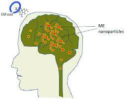 Illustration of the deep brain stimulation approach. Illustration of... |  Download Scientific Diagram