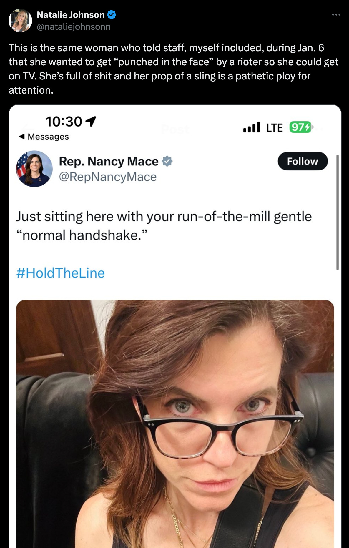 This is the same woman who told staff, myself included, during Jan. 6 that she wanted to get “punched in the face” by a rioter so she could get on TV. She’s full of shit and her prop of a sling is a pathetic ploy for attention. This is the same woman who told staff, myself included, during Jan. 6 that she wanted to get “punched in the face” by a rioter so she could get on TV. She’s full of shit and her prop of a sling is a pathetic ploy for attention.