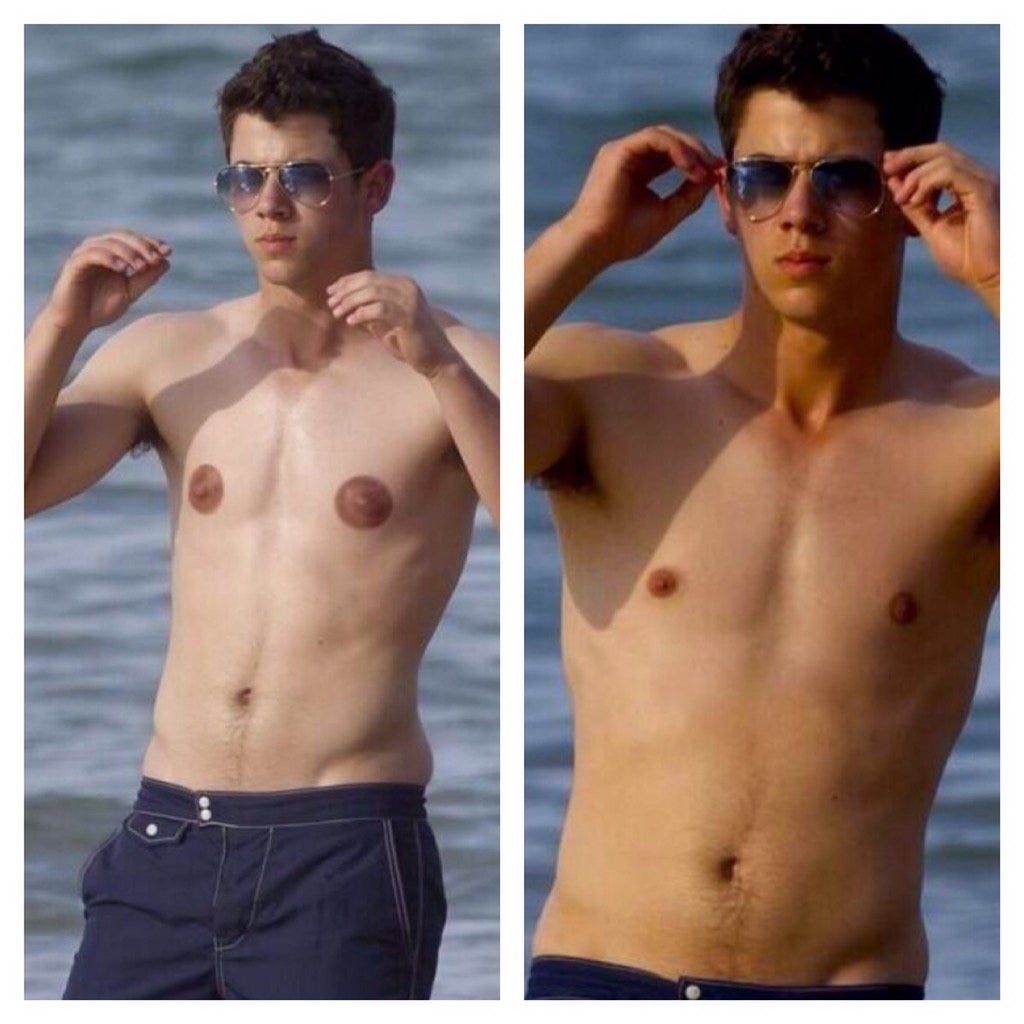 Nick Jonas big nipples are a #photoshophoax @katetimmarty