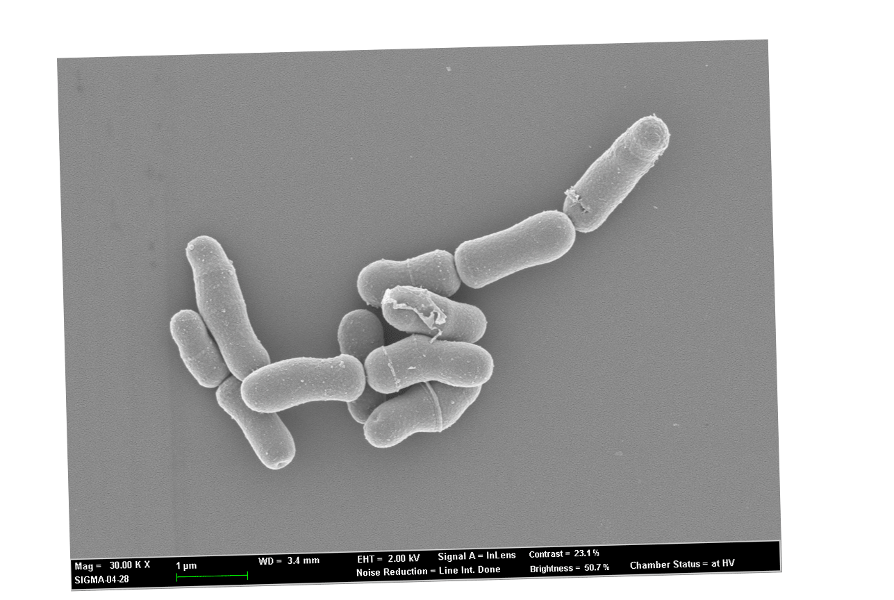 Scanning electron microscope image of Bifidobacteria (kinda lil tic tac guys)