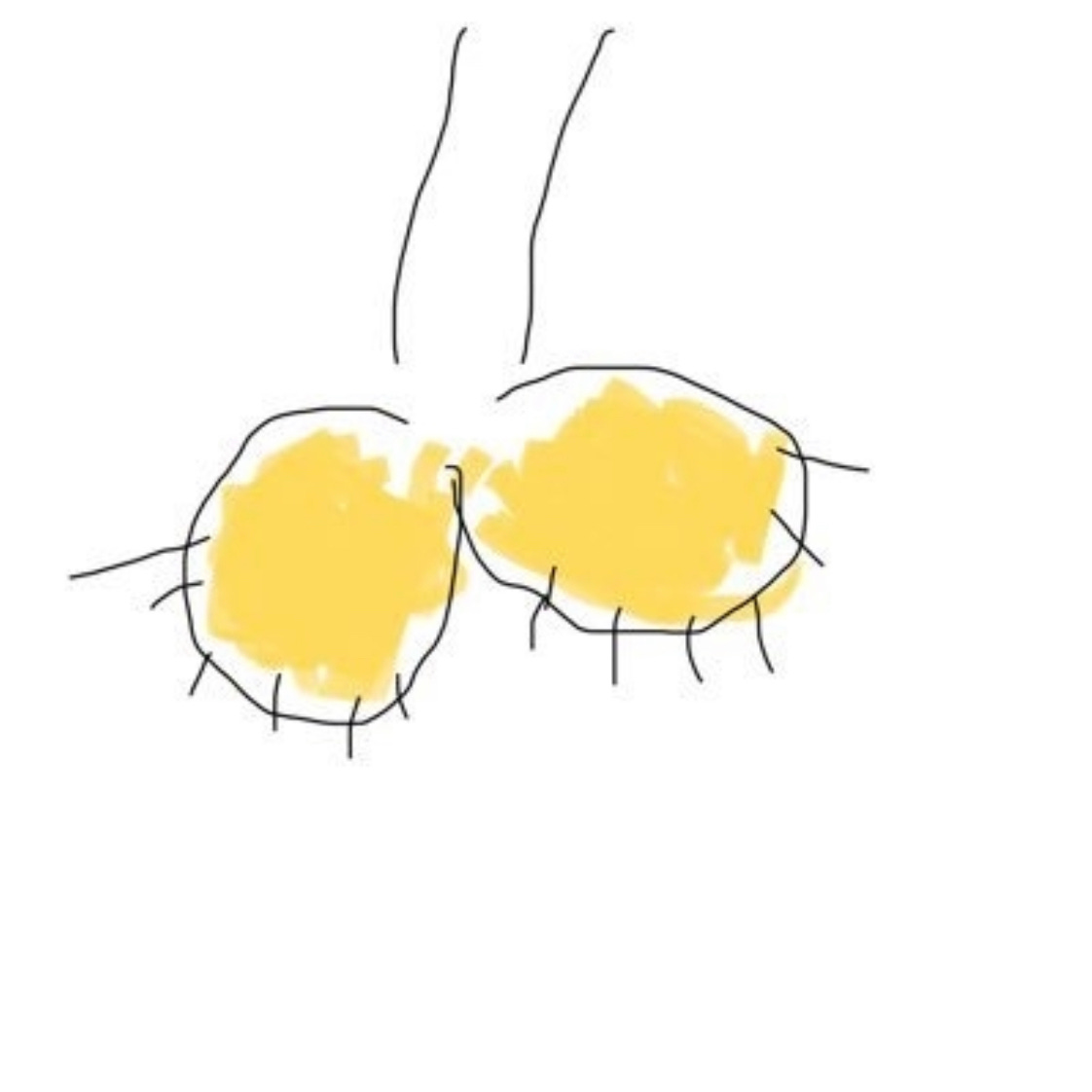 A Tale of Multiple Nezo(s)