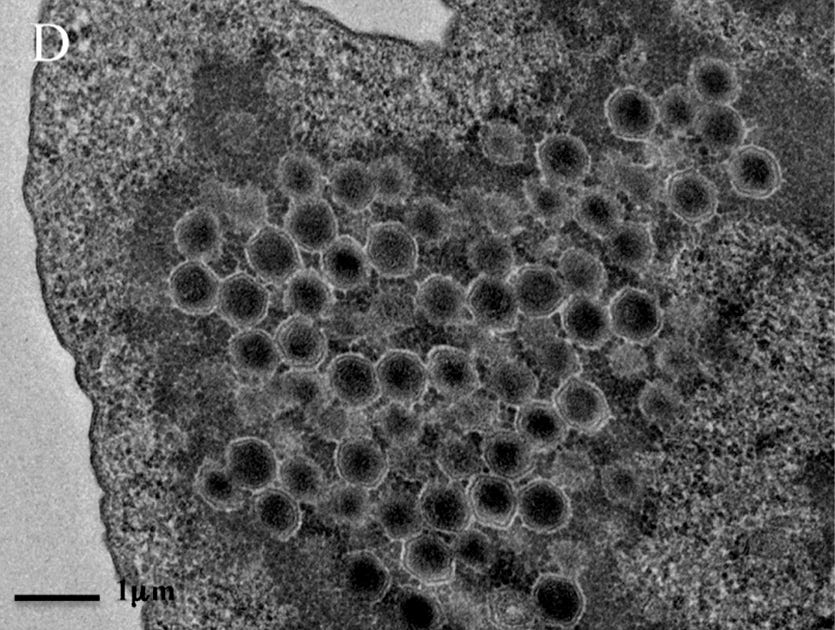 Partículas virais preenchem o corpo da ameba, indicando uma fase final de infecção depois da reprodução do vírus dentro do organismo unicelular Partículas virais preenchem o corpo da ameba, indicando uma fase final de infecção depois da reprodução do vírus dentro do organismo unicelular