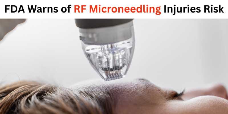 FDA warns of RF Microneedling Risk