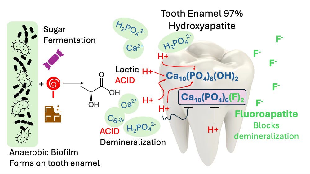 schematic about tooth decay before and after fluoride is added schematic about tooth decay before and after fluoride is added