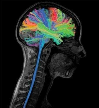 Aphantasia and Psychedelics