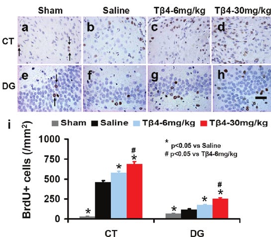 Figure: Tβ4 treatment increases BrdU-positive proliferating cells after traumatic brain injury Figure: Tβ4 treatment increases BrdU-positive proliferating cells after traumatic brain injury