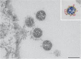 Elektronenmikroskopische Bilder und ...