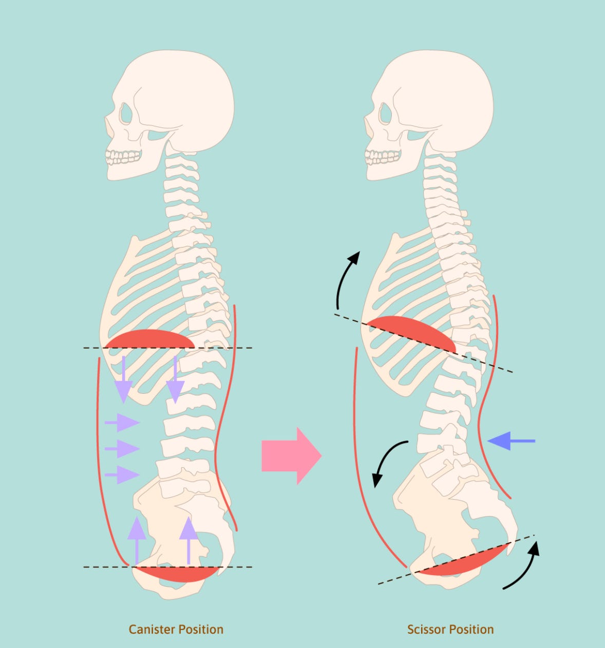 Stacking The Ribcage and Pelvis: What It Means, Why It Matters, And How To  Do It