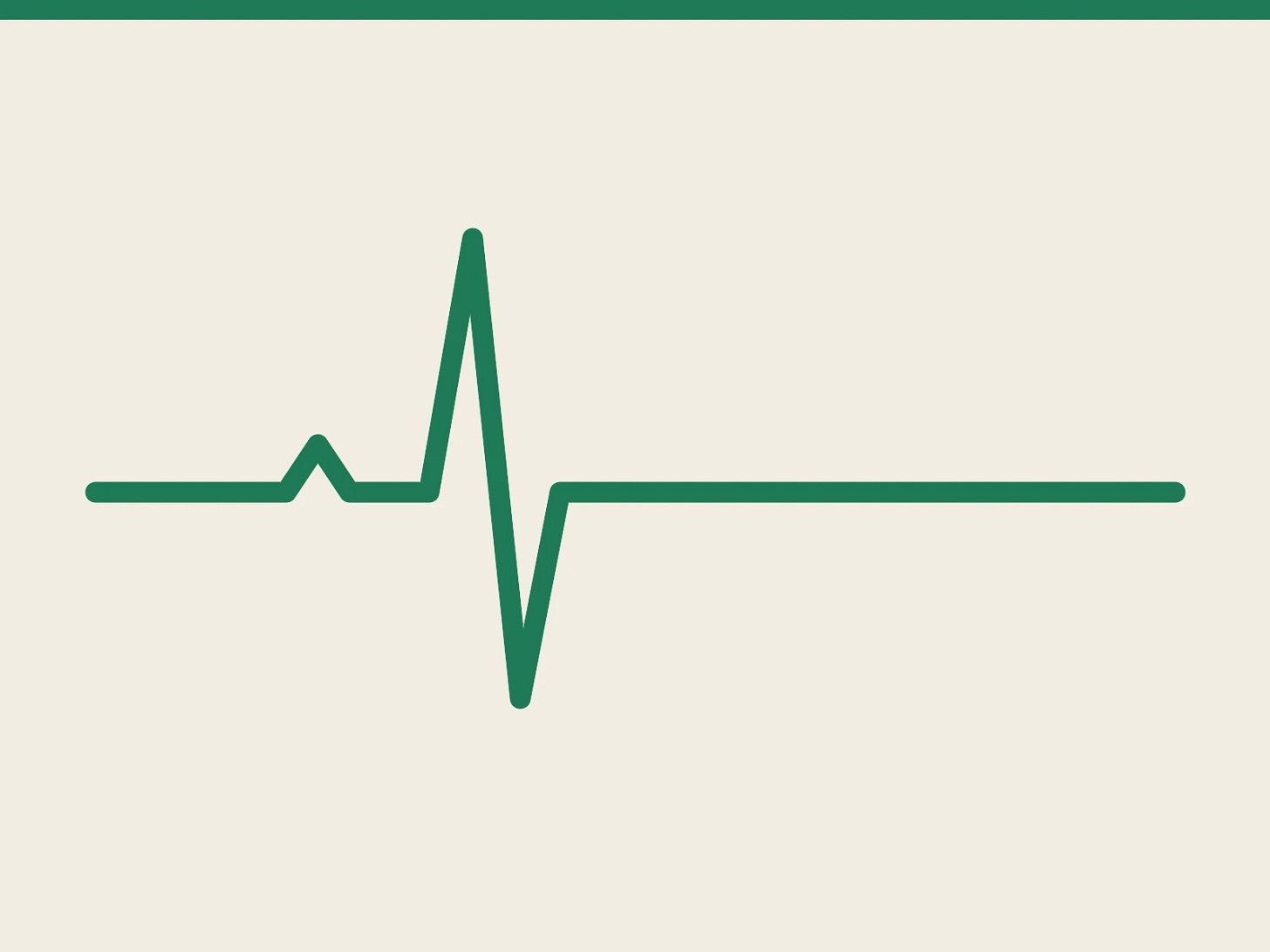 A heartbeat line that flatlines A heartbeat line that flatlines