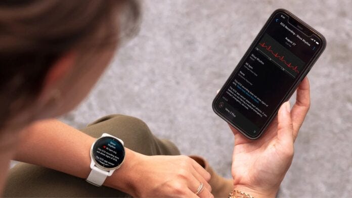 garmin-venu-2-plus-app-ecg-come-funziona Garmin Venu 2 Plus app ECG come funziona
