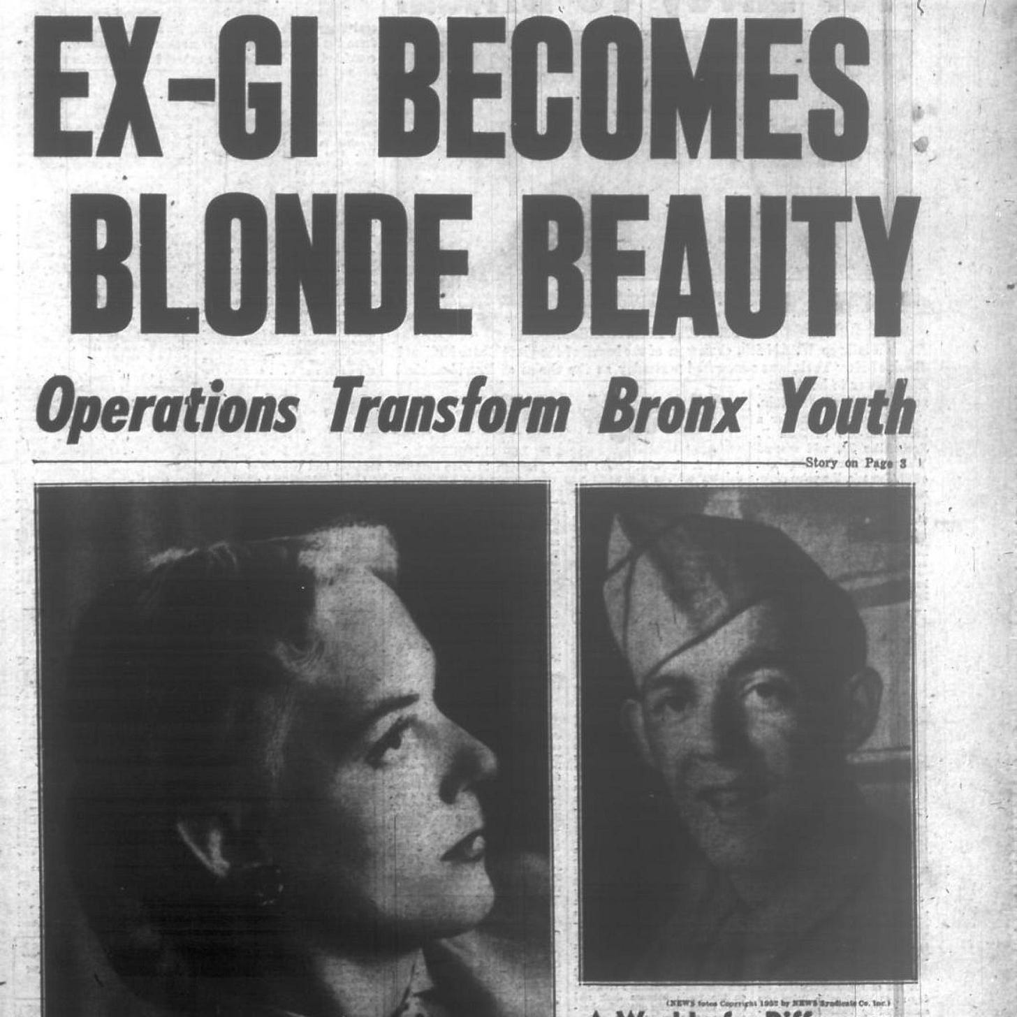 Bronx Army vet undergoes first widely known gender ...