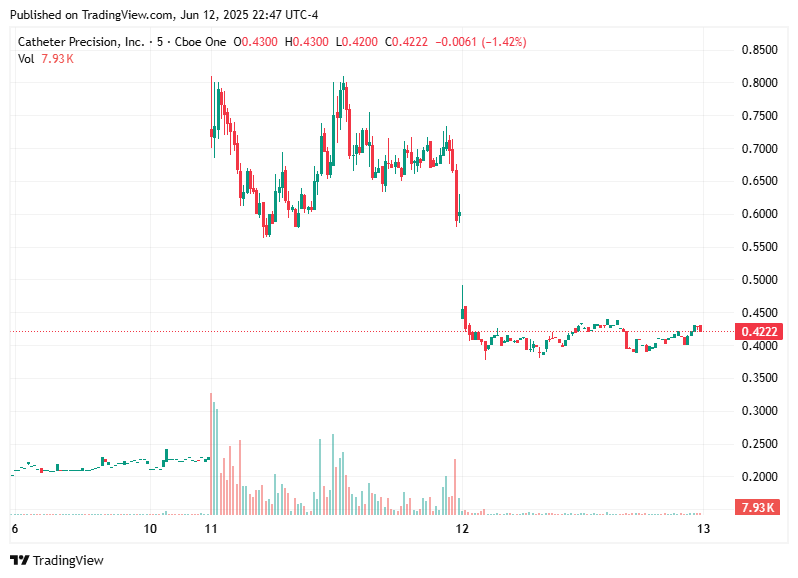 TradingView chart TradingView chart