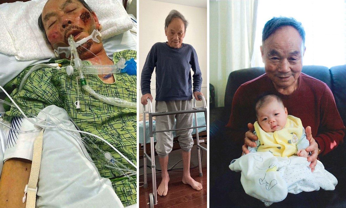 Sun Ng Before-After Ivermectin