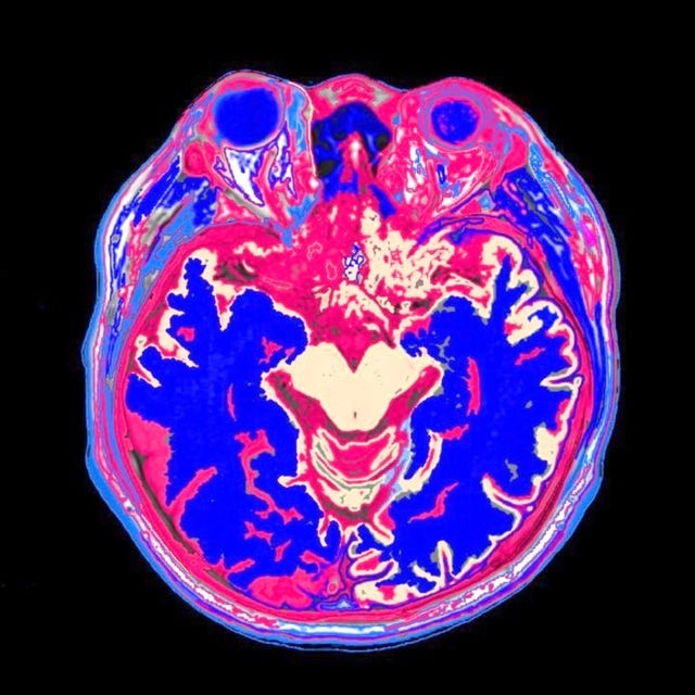 healthy brain, mri scan