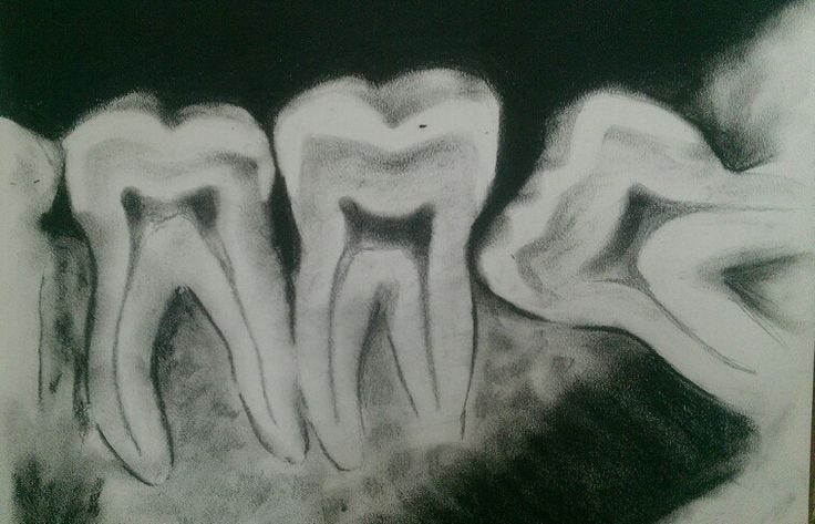 This may contain: a black and white drawing of tooth shapes