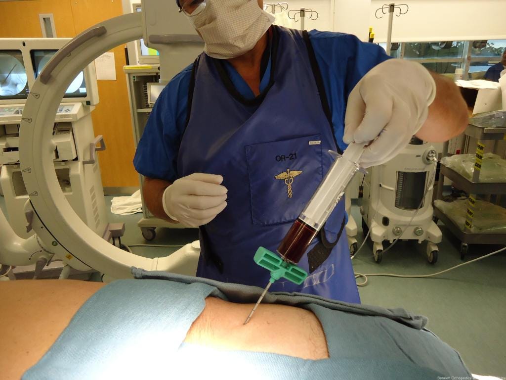 Stem Cell Therapy and Treatment Sarasota, Tampa, Orlando