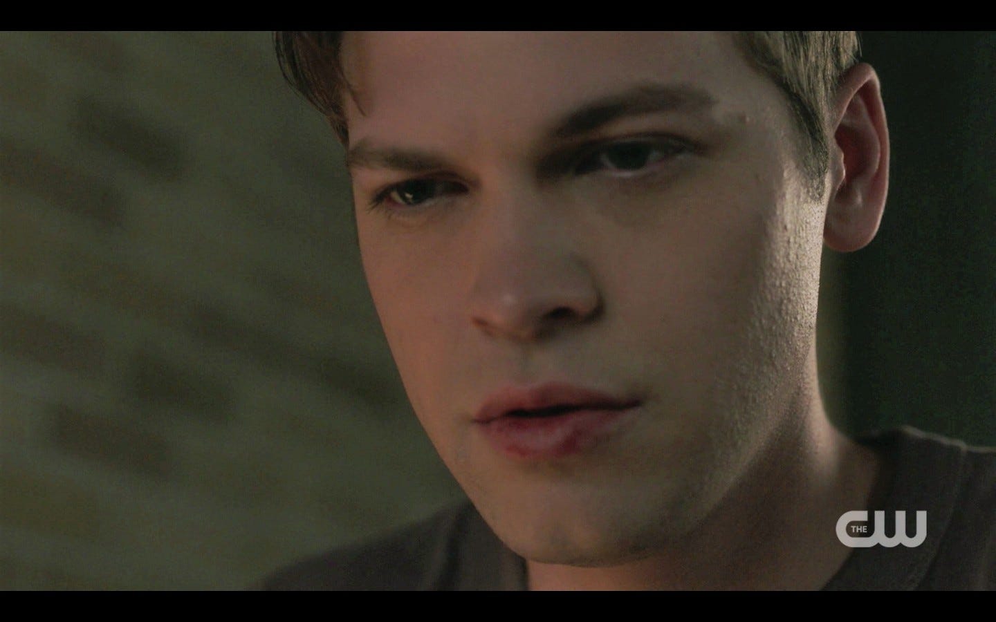 jack trashcan full of bloody tissues spn 1403