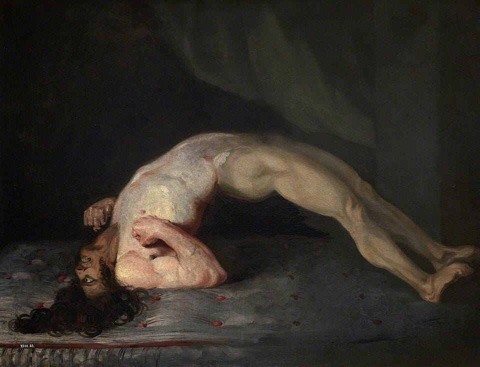 File:Opisthotonus in a patient suffering from tetanus - Painting by Sir Charles Bell - 1809.jpg File:Opisthotonus in a patient suffering from tetanus - Painting by Sir Charles Bell - 1809.jpg