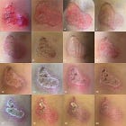 Can the Mind Heal Terminal Disease?