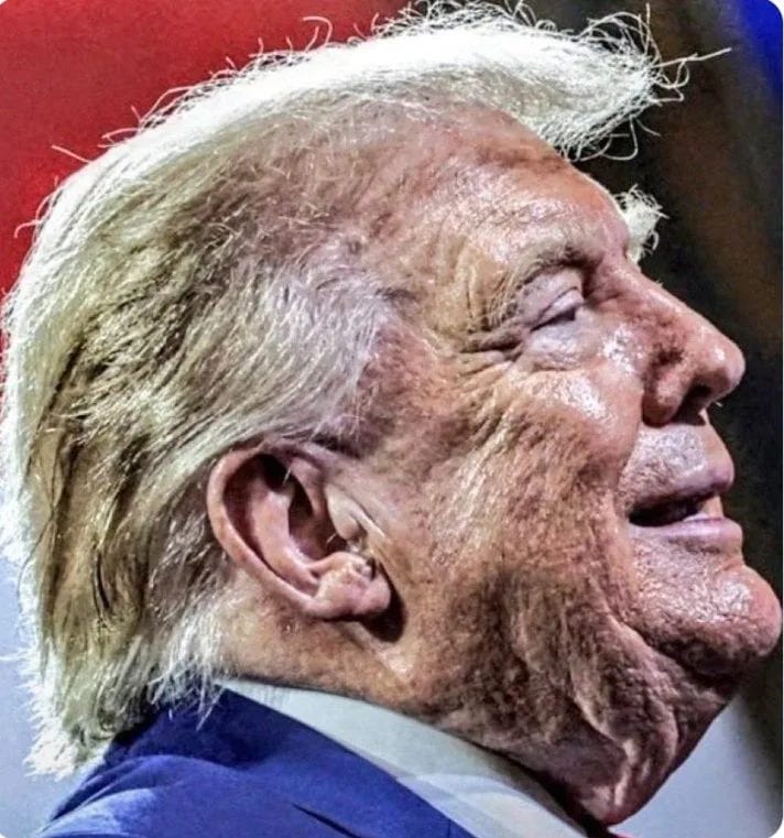 Fact Check: Doctored Trump Pic Exaggerates Face Wrinkles, Adds Blemishes And Makes Him Paler Fact Check: Doctored Trump Pic Exaggerates Face Wrinkles, Adds Blemishes And Makes Him Paler