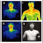 Can Cold Exposure Generate Vitamin D?