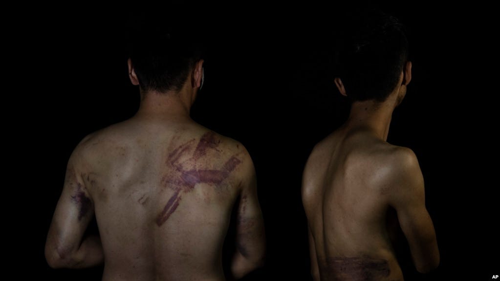 FILE - Afghan journalists Neamatullah Naqdi and Taqi Daryabi pose at a newspaper office after they were beaten by Taliban forces while covering a women's protest in Kabul on Sept. 10, 2021. Media groups on Aug. 11, 2023, demanded that the Taliban stop its crackdown on the press.