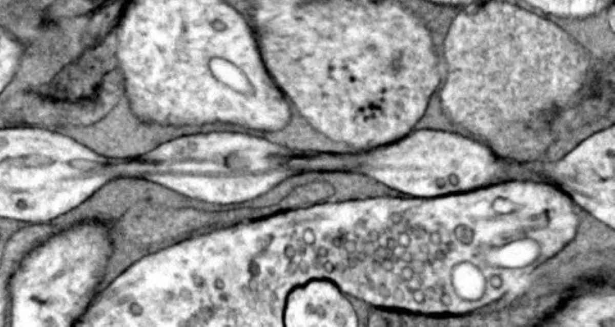 https://neurosciencenews.com/files/2024/12/axon-shape-neuroscience.jpg
