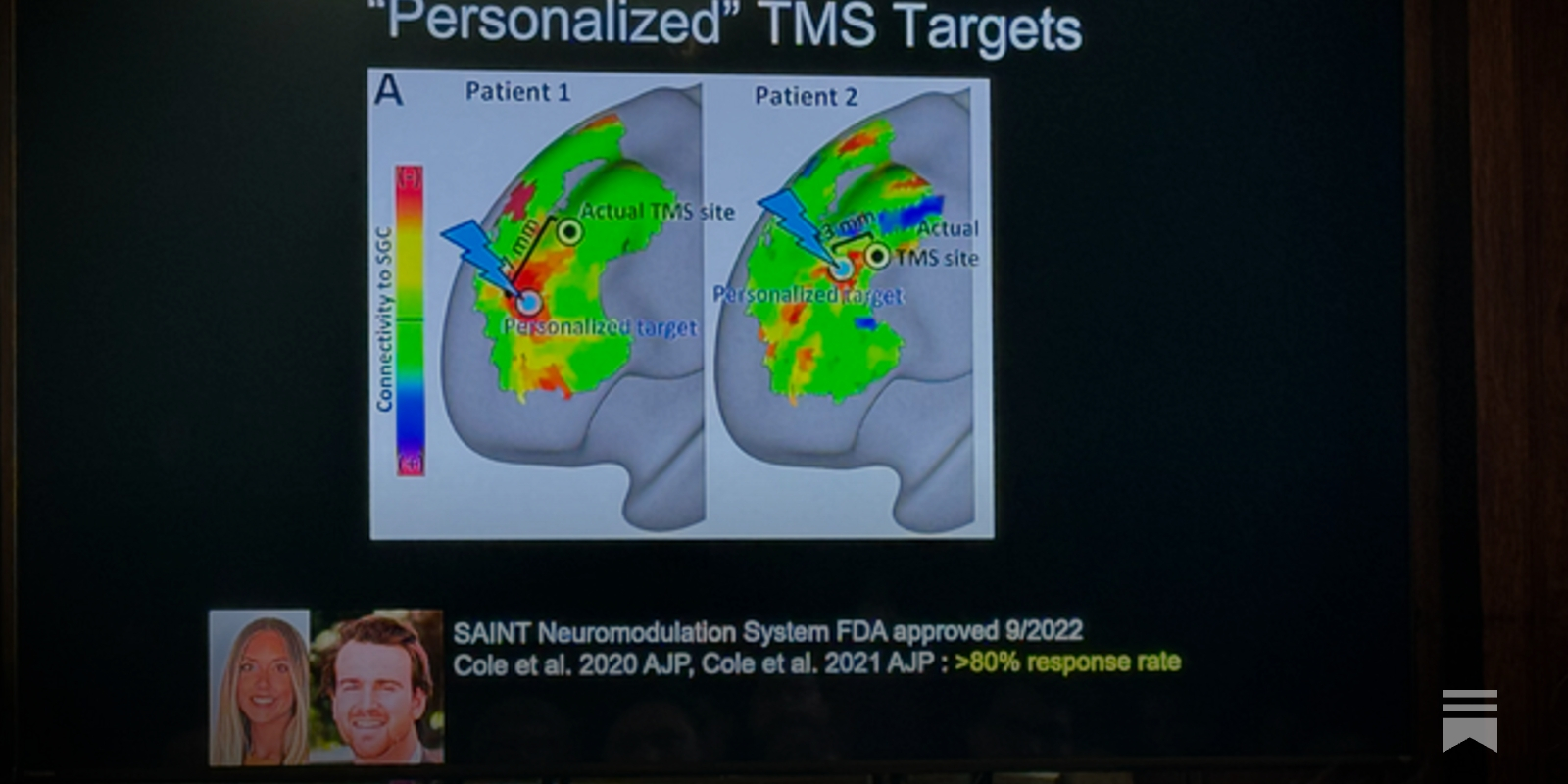 BRAIN UPDATE MOZART GST　（グレートサクセス） Do Brain Scans Have A Place in Depression Treatment?