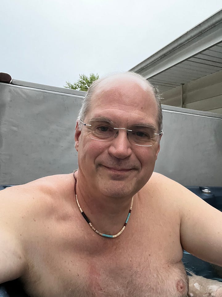 Left image: A close-up, topless portrait of a smiling woman with a large, dark, voluminous afro and dark skin. She has wide, bright eyes and is looking directly at the camera. Her areolas are dark brown, and the left breast has several patches of lighter, depigmented skin, possibly due to vitiligo, extending from the bottom of the areola. The background is a brightly lit, modern bathroom. Right Image: A head-and-shoulders, topless photo of a middle-aged man with pale skin, a partially bald head, and silver-rimmed glasses, smiling slightly at the camera. He is wearing a short, multicolored beaded necklace featuring tan, brown, and turquoise beads. He is in an outdoor hot tub, with the metallic grey side of the tub and a white awning visible in the background against a cloudy sky.