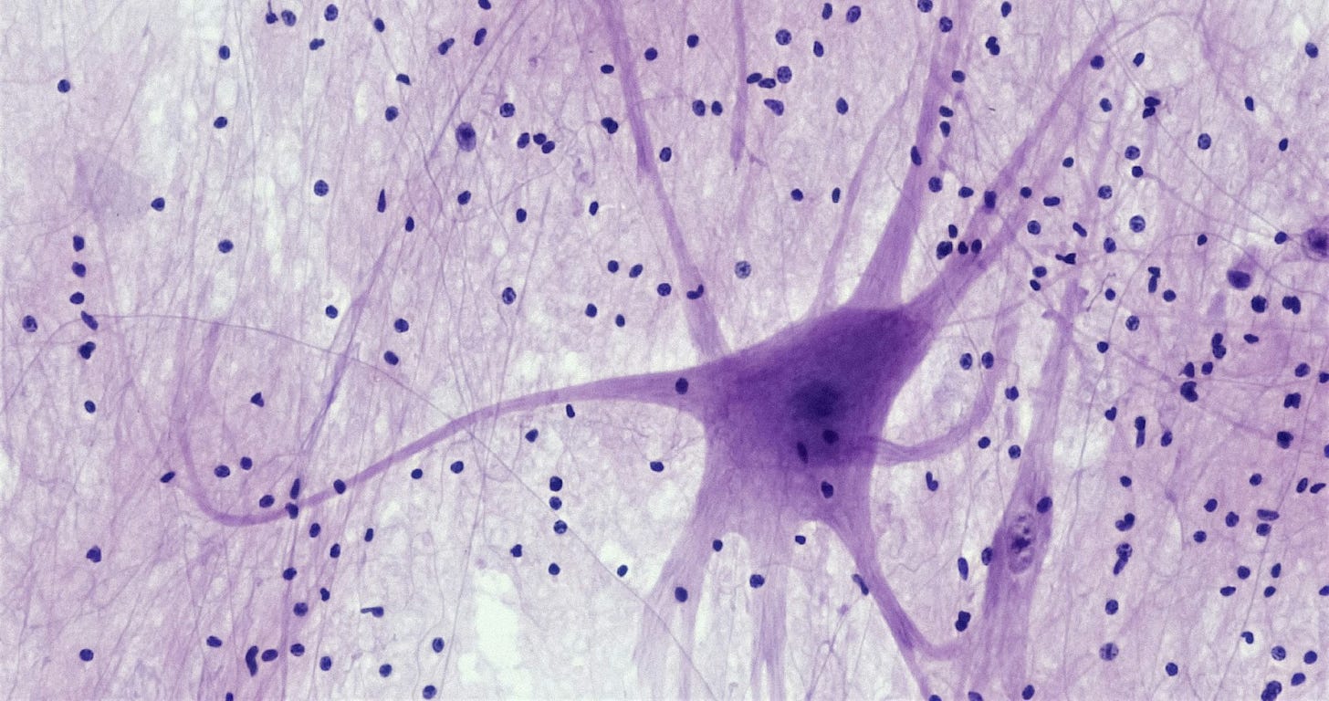 microscope image of a neuron stained pink