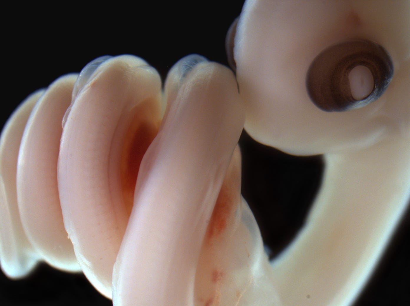 Devo ASU Blog: Children's Python Embryos
