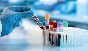 3 Reasons to Get a Blood Test | The Health Suite Leicester