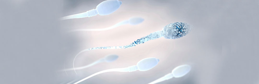 Understanding Unhealthy Sperm Symptoms | Shreeivf Clinic