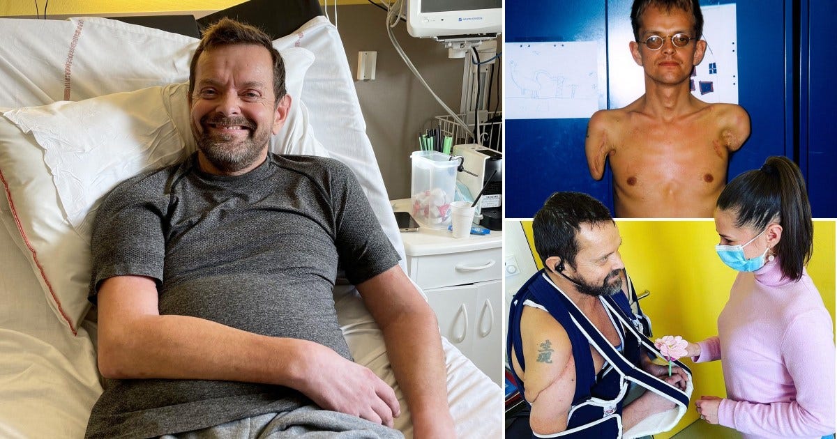 Man who underwent world's first double arm transplant can now flex his biceps | Metro News Man who underwent world's first double arm transplant can now flex his biceps | Metro News