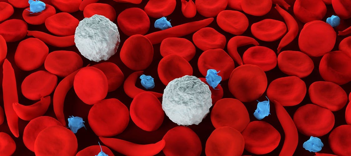 Sickle Cell Disease | Johns Hopkins Medicine